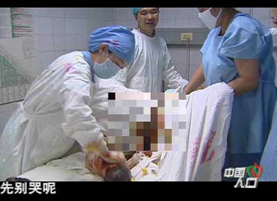 中国女人分娩顺产图片_中国人口 直播分娩
