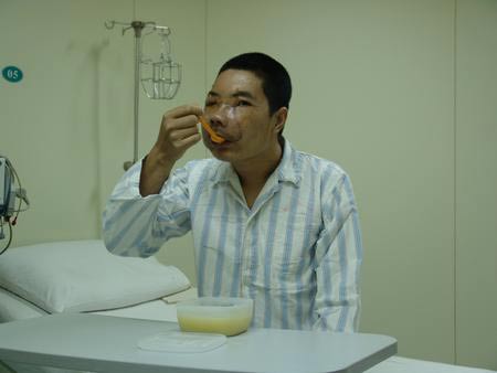 專訪中國換臉手術醫生：換明星臉不太現實