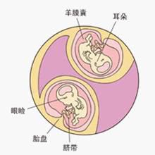 女婴扎针下胎生男_寄生胎图片_印度一女婴体内有8个寄生胎