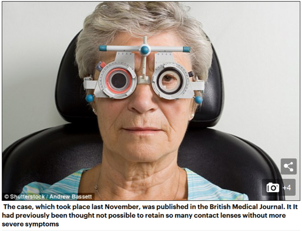双语:老妇眼睛不适就医 竟取出27枚隐形眼镜