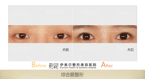 ����������۲�����