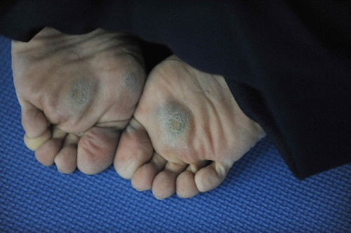 图文认识武搏会合气道项目磨出厚茧的双脚